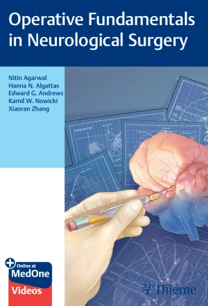 Operative Fundamentals in Neurological Surgery